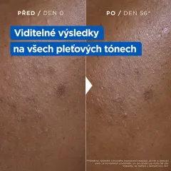 Mixa Niacinamide Bright Moisturizing Anti-Dark Spot Cream thumbnail 3