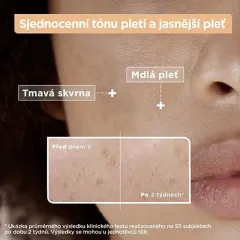 Mixa Vitamin c + glycolic acid anti-dark spot serum thumbnail 3