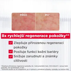 Mixa Balm Cica+ Recovery Balm thumbnail 3