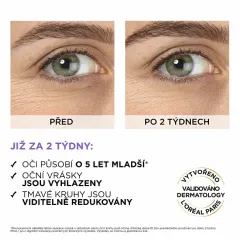 Loreal Revitalift Filler HA 2,5% thumbnail 3