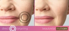 BeautyRelax Cosmetic device Multicare BR-1380 thumbnail 7