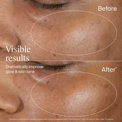Neutrogena Collagen Bank Serum with Vitamin C thumbnail 6