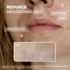 Mixa Salicylic acid + niacinamide anti-imperfection serum thumbnail 6