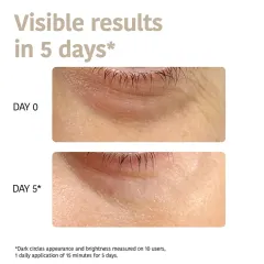Iroha Anti-aging Eye Contour Patches 2 x thumbnail 4