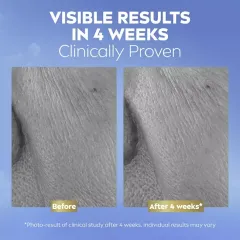 Nivea Anti-wrinkle serum Q10 Repairing Serum thumbnail 5
