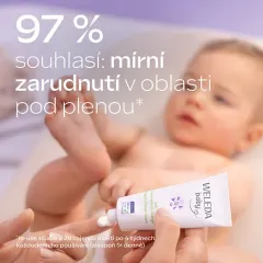 Weleda Derma 3in1 Nappy Change Cream (50 ml) thumbnail 3