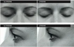 Tolure Cosmetics Eyeshine anti-wrinkle eye cream 15 ml thumbnail 3